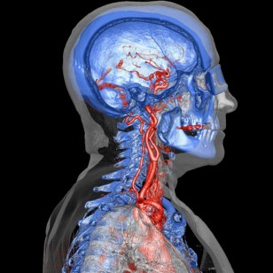 Рис. 2: Обычный рентгеновский снимок грудной клетки, на котором область костей белая.